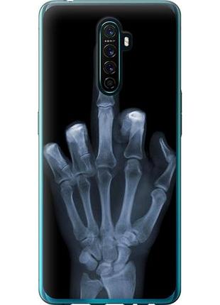 Чехол на oppo reno ace рука через рентген из пластика fch_0152498