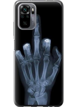 Чохол для xiaomi poco m5s з силікону fch_0047917