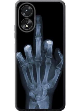 Чехол на oppo a38 4g рука через рентген из силикона fch_0152519