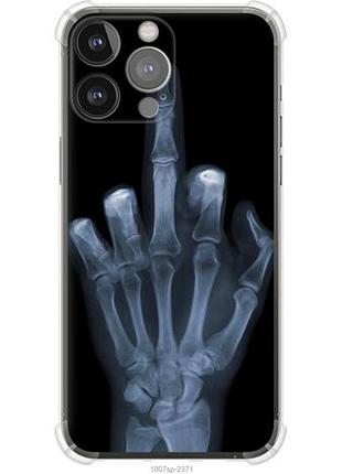 Чехол на iphone 13 pro max рука через рентген из силикона fch_0152509