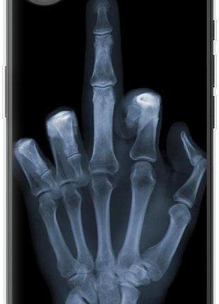 Чехол на iphone 16e рука через рентген из силикона fch_0152571