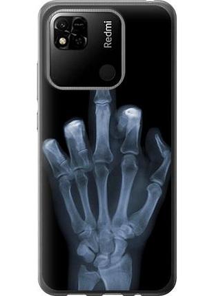 Чехол на xiaomi redmi 9c рука через рентген из силикона fch_0007873