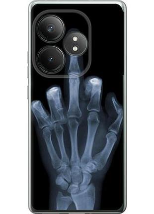 Чехол на realme gt neo6 se рука через рентген из силикона fch_0152541