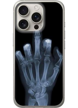 Чехол на iphone 16 pro рука через рентген из силикона fch_0142885