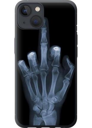 Чехол на iphone 13 рука через рентген из силикона fch_0007898