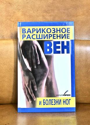 варикозне розширення вен і хвороби ніг