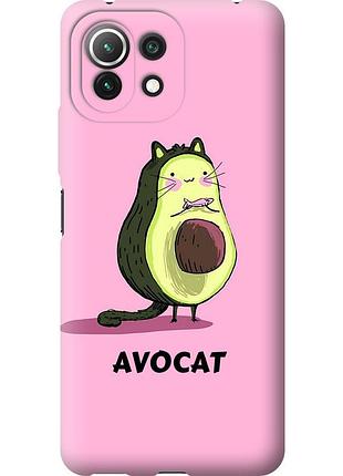 Чехол силиконовый на телефон xiaomi mi 11 lite avocat "4270u-2281-58250"