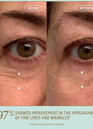 Крем для глаз biossance squalane + marine algae eye cream