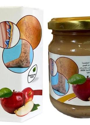 Lotus massage apple cider vinegar мазь от варикоза
