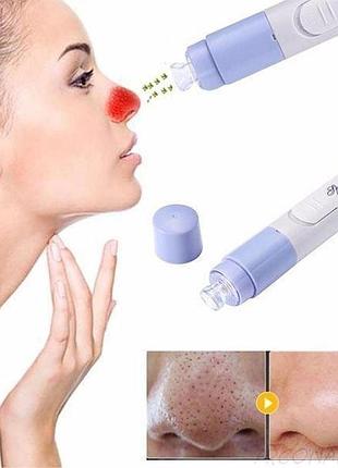 Вакуумный очиститель spotcleaner face pore cleaner вакуумный очиститель пор лица wb-71