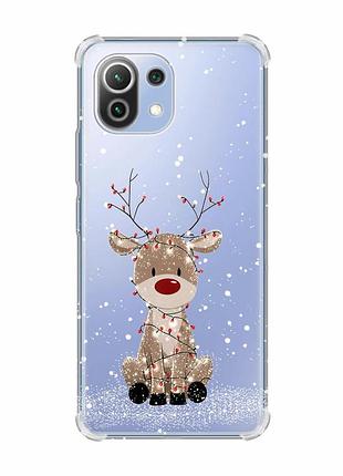 Чехол с утолщёнными углами на xiaomi mi 11 lite олень новый год (принт 429)