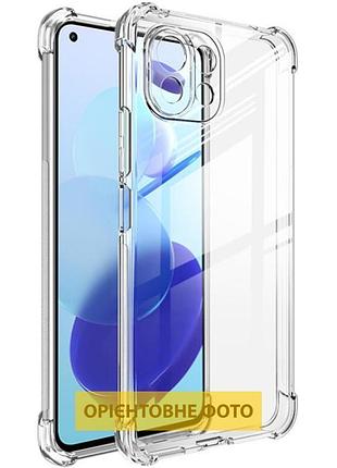 Tpu чохол getman ease logo посилені кути full camera для xiaomi redmi 15 4g (global) / 5g безбарвний (прозорий)