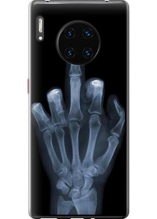 Чехол на huawei mate 30 pro рука через рентген из силикона fch_0165765