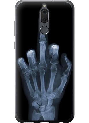 Чохол для huawei mate 10 lite з пластику fch_0165769