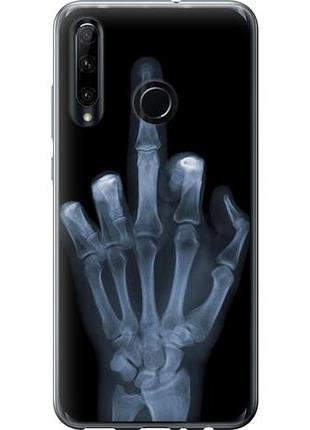 Чехол на huawei honor 10i рука через рентген из силикона fch_0165758