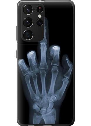 Чехол на samsung galaxy s21 ultra (5g) рука через рентген из пластика fch_0007863