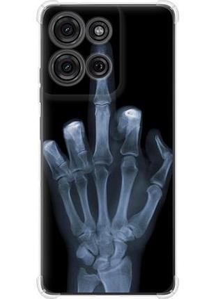 Чехол на motorola moto g75 5g рука через рентген из силикона fch_0168776