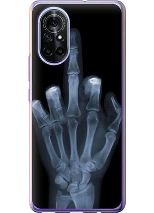 Чехол на huawei nova 8 рука через рентген из силикона fch_0168757