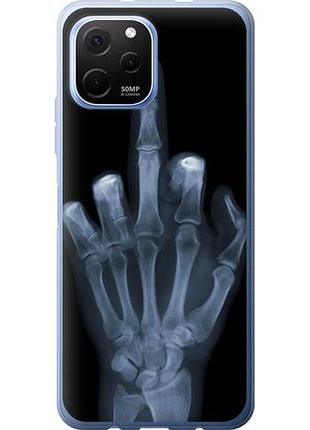Чехол на huawei nova y61 рука через рентген из силикона fch_0168766