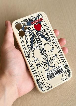 Креативний молочний чохол body checkup скелет для iphone