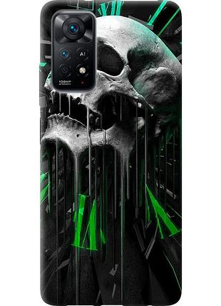 Чохол силіконовий на телефон xiaomi redmi note 11 череп-годинник "4100u-2516-58250"