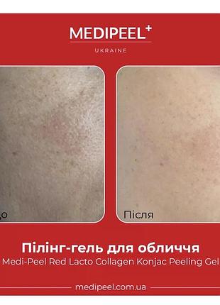 Пілінг-скатка з колагеном medi-peel red lacto collagen konjac peeling gel 95 мл 2