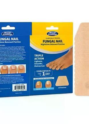 Пластыри от грибка ногтей royal prestige fungal nail 16 шт для ночного ухода