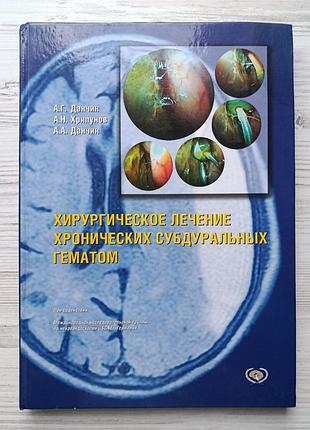 Хирургическое лечение хронических субдуральных гематом. а.г. данчин, а.н. хрипунов, а.а. данчин