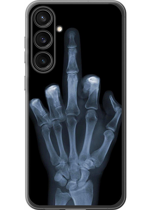 Чохол на samsung galaxy s23 fe рука через рентген "1007u-3136-851"