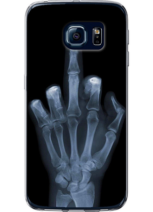 Чохол на samsung galaxy s6 edge g925f рука через рентген "1007u-83-851"