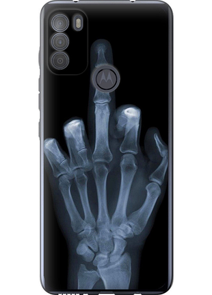 Чохол на motorola g50 рука через рентген "1007u-2354-851"