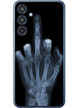 Чохол на samsung galaxy m35 5g рука через рентген "1007u-3738-851"