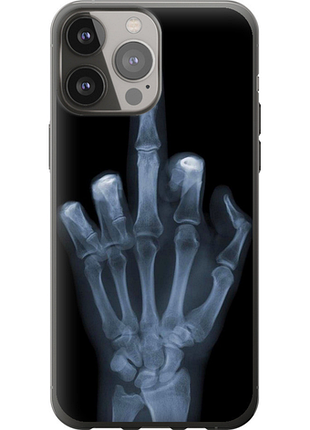 Чохол на iphone 13 pro max рука через рентген "1007u-2371-851"