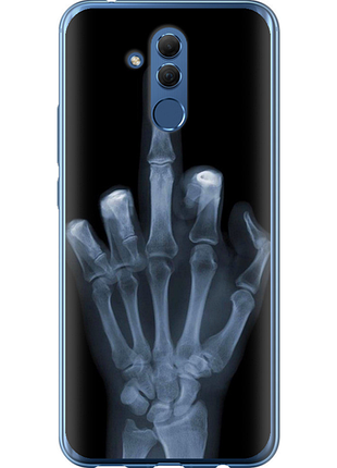 Чохол на huawei mate 20 lite рука через рентген "1007u-1575-851"
