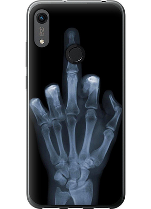 Чохол на huawei honor 8a рука через рентген "1007u-1635-851"