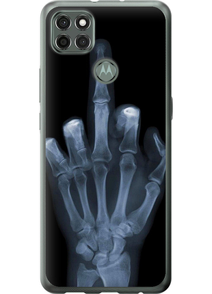 Чохол на motorola g9 power рука через рентген "1007u-2229-851"