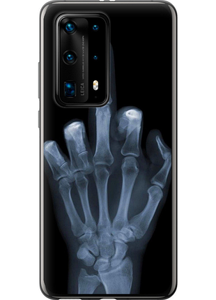 Чохол на huawei p40 pro plus рука через рентген "1007u-1917-851"