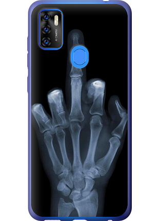 Чохол на zte blade a7s 2020 рука через рентген "1007u-2454-851"