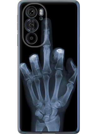 Чохол на motorola edge 30 pro рука через рентген "1007u-2826-851"