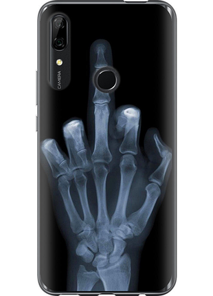 Чохол на huawei y9 prime 2019 рука через рентген "1007u-1736-851"