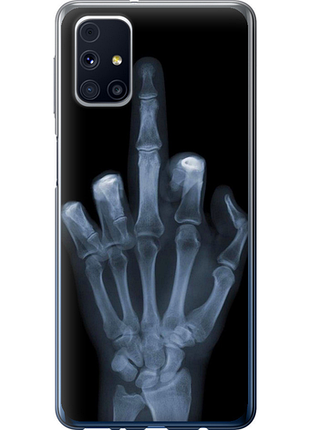 Чохол на samsung galaxy m31s m317f рука через рентген "1007u-2055-851"