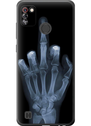 Чохол на tecno pop 4 pro bc3 рука через рентген "1007u-2444-851"