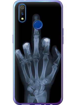 Чохол на realme 3 pro рука через рентген "1007u-1863-851"