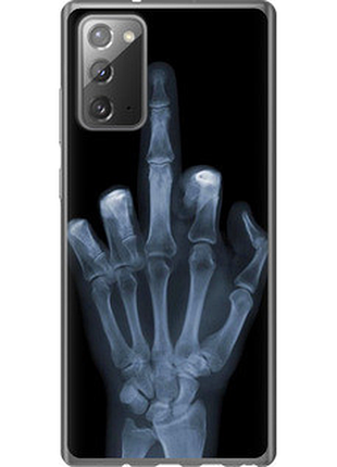 Чохол на samsung galaxy note 20 рука через рентген "1007u-2036-851"