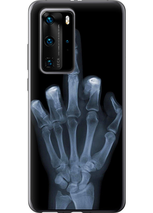 Чохол на huawei p40 pro рука через рентген "1007u-1839-851"