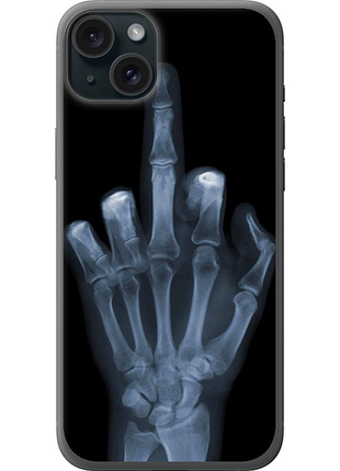 Чохол на iphone 15 plus рука через рентген "1007u-3097-851"