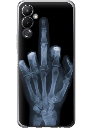 Чохол на tecno pova 4 lg7n рука через рентген "1007u-2967-851"