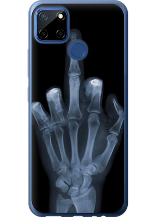 Чохол на realme c12 рука через рентген "1007u-2240-851"