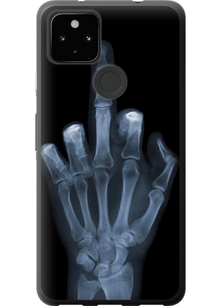 Чохол на google pixel 5a рука через рентген "1007u-2286-851"