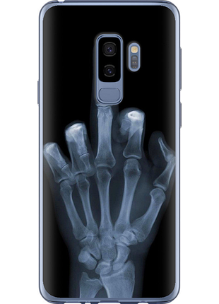 Чохол на samsung galaxy s9 plus рука через рентген "1007u-1365-851"